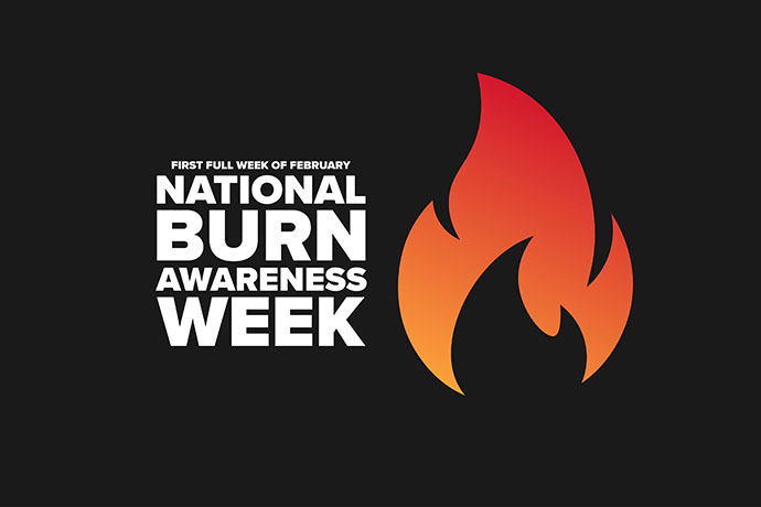 National Burn Awareness safety consulting visual